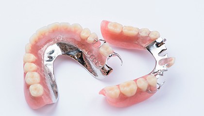 Partial dentures upside down to show clips