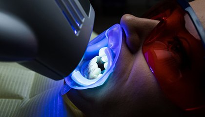 a patient undergoing the in-office teeth whitening process